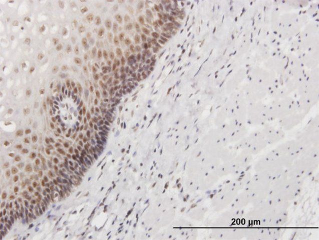 Anti-HSPC111 antibody produced in mouse