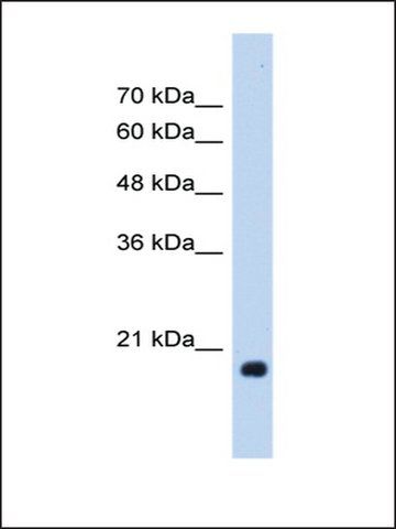 Anti-HSPB6 antibody produced in rabbit