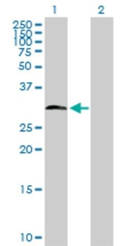 Anti-HDAC7A antibody produced in rabbit