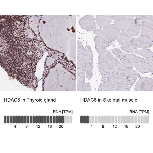 Anti-HDAC8 antibody produced in rabbit