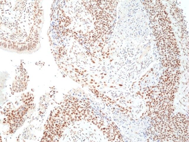 Anti-HDAC3 Rabbit Monoclonal Antibody