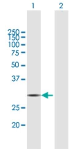 Anti-HDHD2 antibody produced in mouse