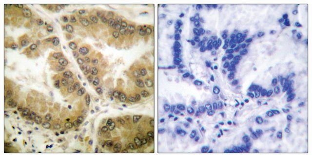 Anti-HDAC7 antibody produced in rabbit