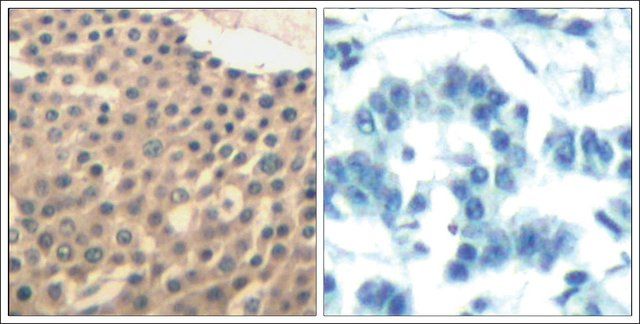 Anti-HDAC9/HDAC4/HDAC5 (Ab-246/259/220) antibody produced in rabbit