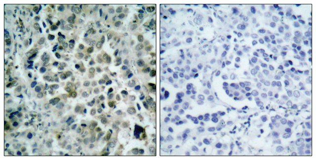 Anti-HDAC8 antibody produced in rabbit