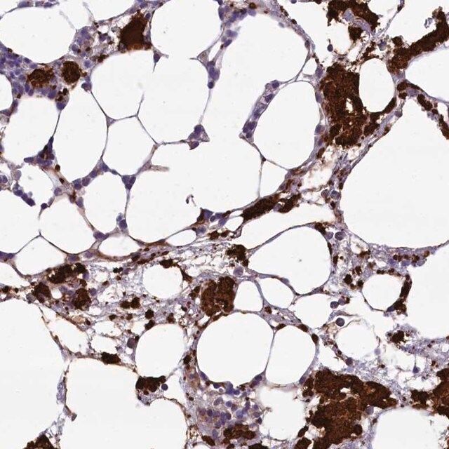 Anti-HEATR3 antibody produced in rabbit