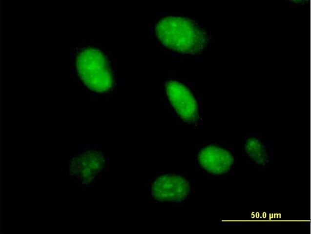 Anti-HDX antibody produced in mouse