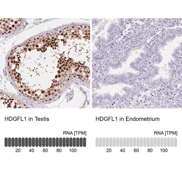 Anti-HDGFL1 antibody produced in rabbit