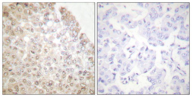 Anti-HDAC5 antibody produced in rabbit