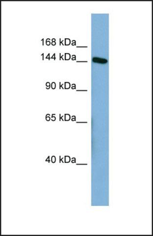 Anti-HDLBP antibody produced in rabbit