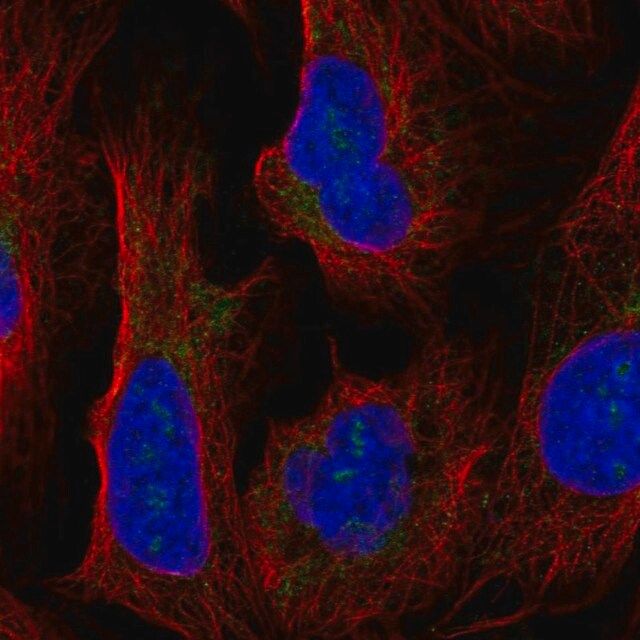 Anti-HEATR1 antibody produced in rabbit