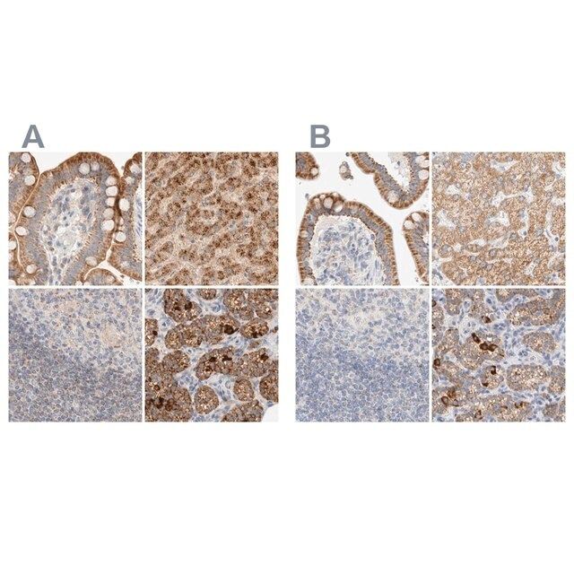 Anti-HDHD3 antibody produced in rabbit