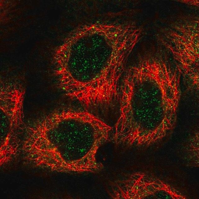 Anti-HEATR5B antibody produced in rabbit