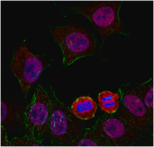 Anti-Hec1 Antibody