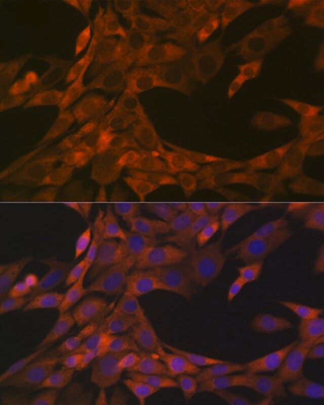 Anti-HE4/WFDC2 antibody produced in rabbit