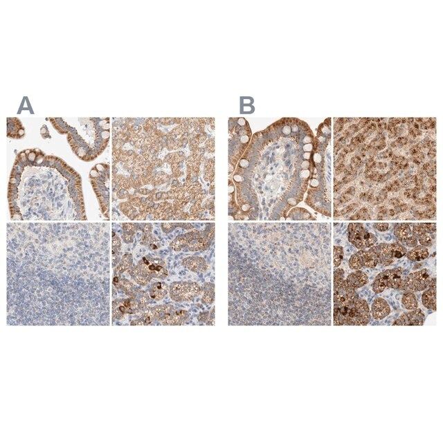 Anti-HDHD3 antibody produced in rabbit