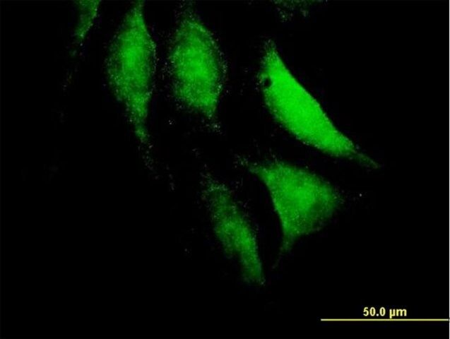 Anti-HECTD2 antibody produced in mouse