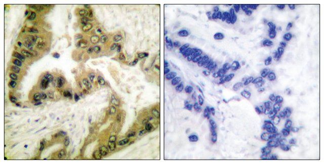 Anti-HDAC10 antibody produced in rabbit