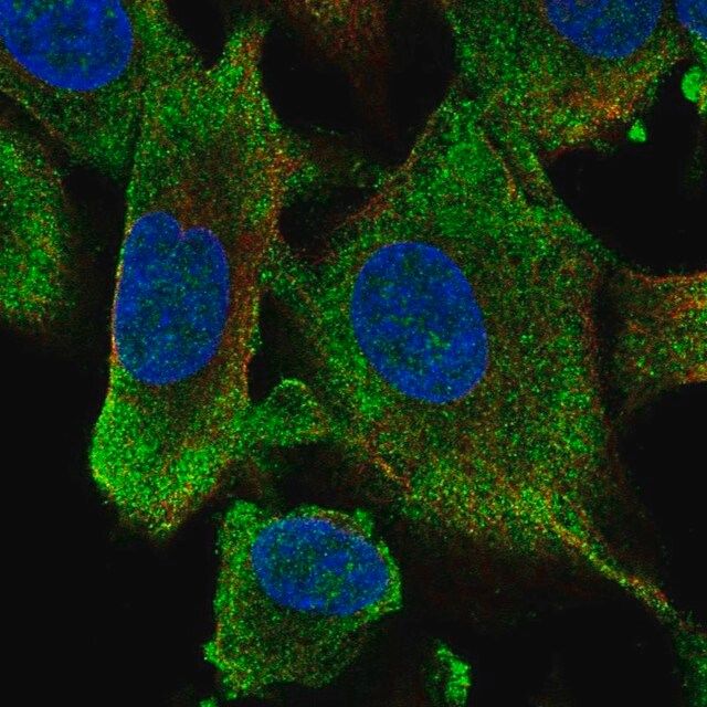 Anti-HECW1 antibody produced in rabbit