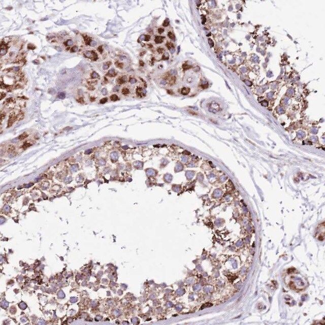 Anti-HECTD4 antibody produced in rabbit