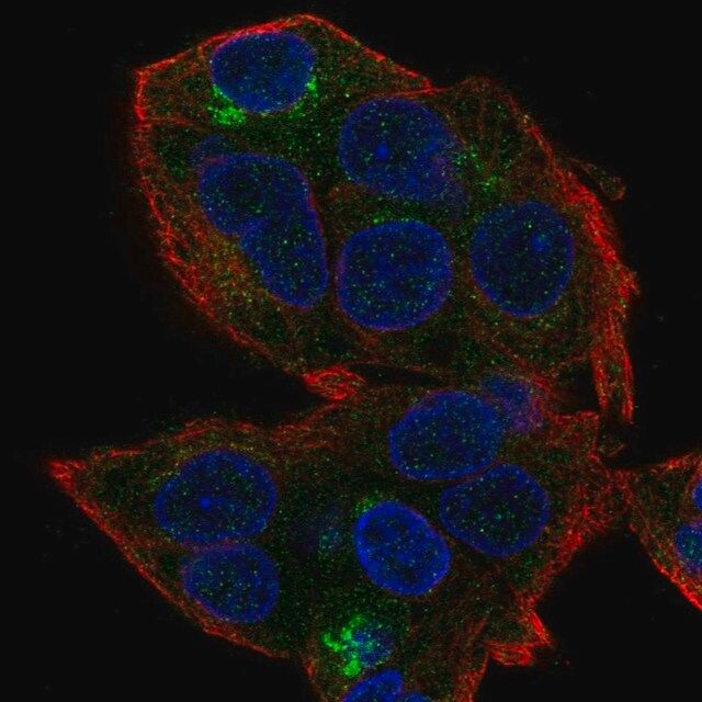 Anti-HEPN1 antibody produced in rabbit