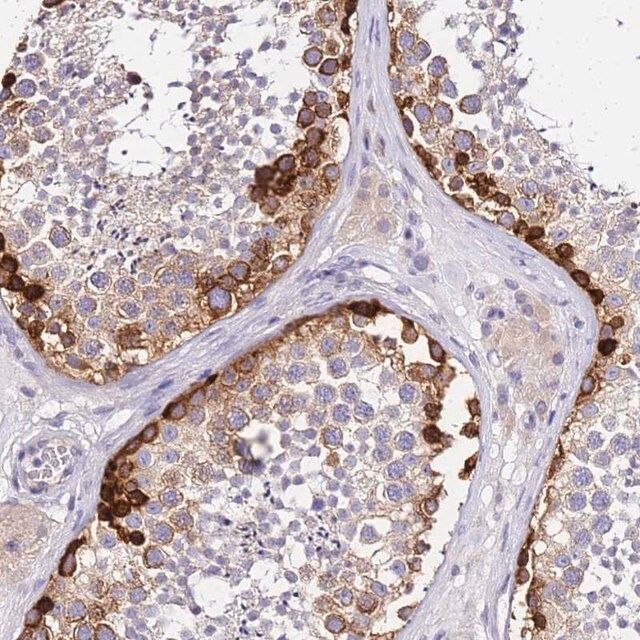 Anti-HERC5 antibody produced in rabbit