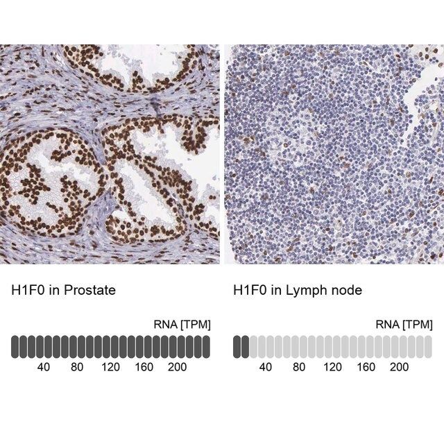 Anti-H1F0 antibody produced in rabbit