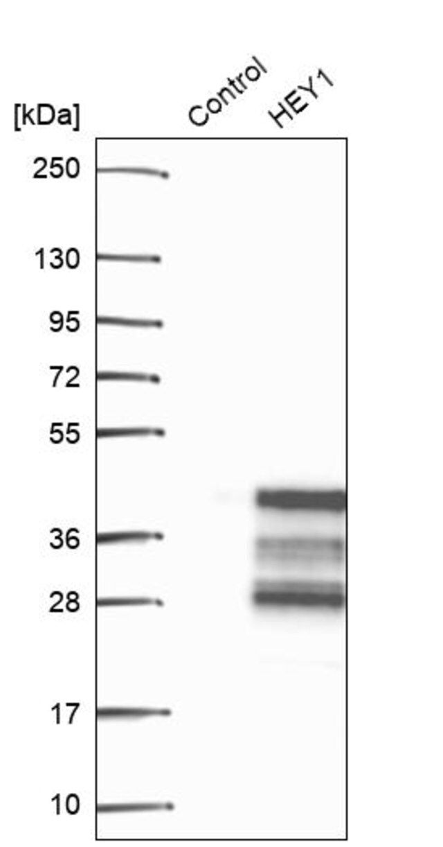 Anti-HEY1 antibody produced in rabbit