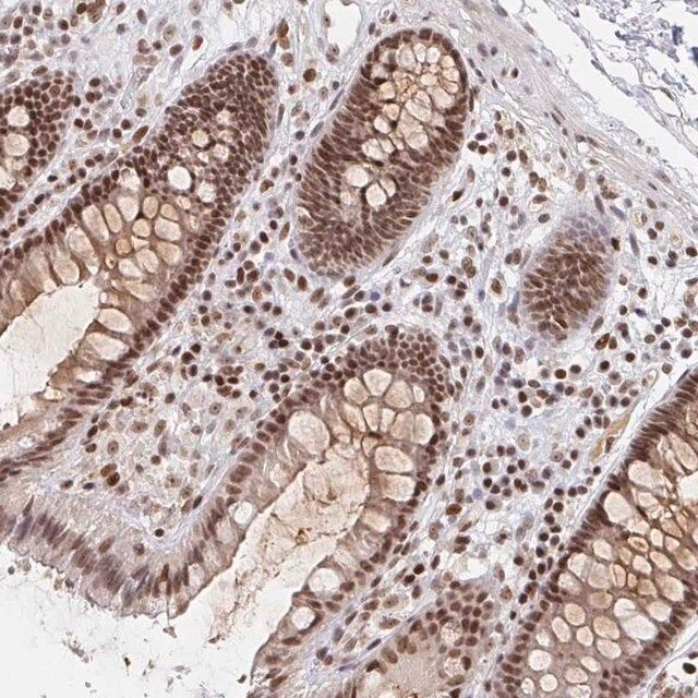 Anti-H1FX antibody produced in rabbit