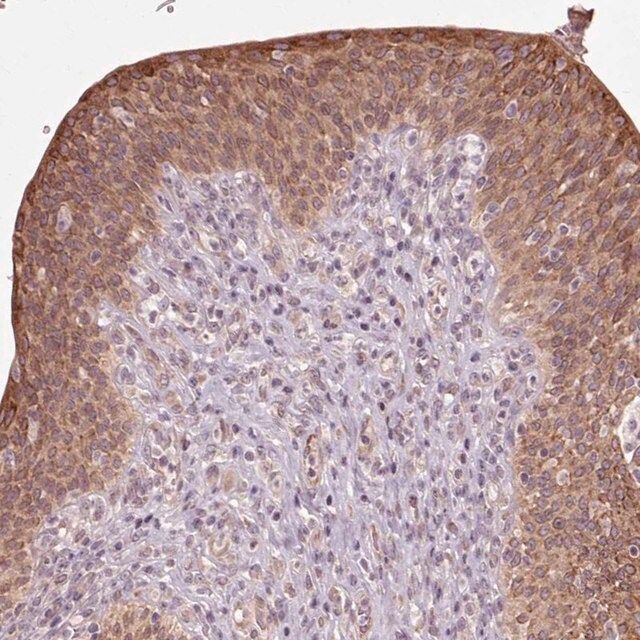 Anti-HAUS5 antibody produced in rabbit