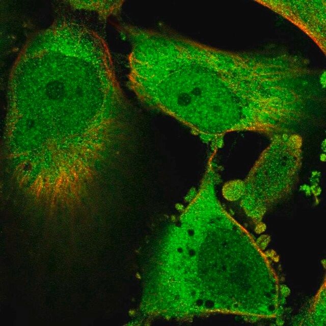 Anti-GLO1 antibody produced in rabbit