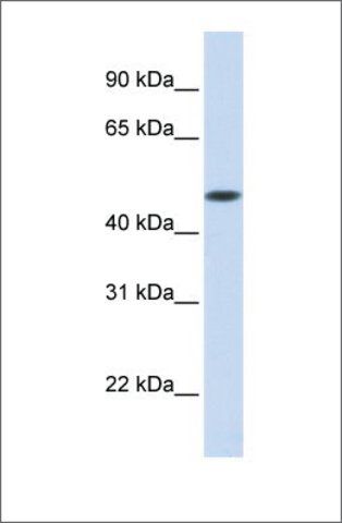 Anti-GLT8D1 antibody produced in rabbit