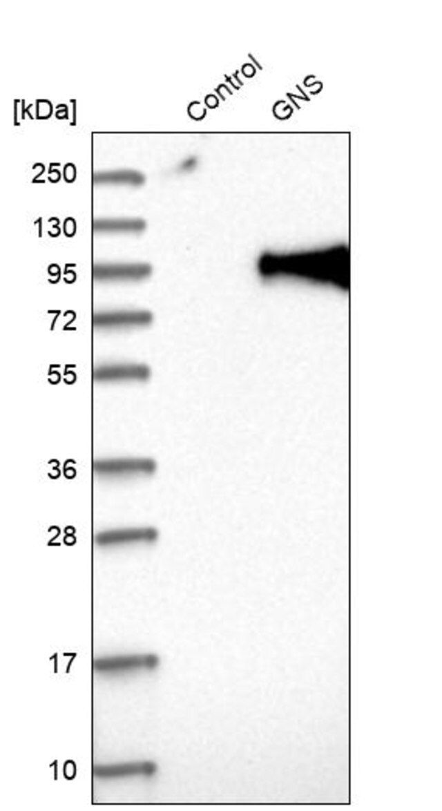 Anti-GNS antibody produced in rabbit