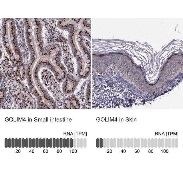 Anti-GOLIM4 antibody produced in rabbit