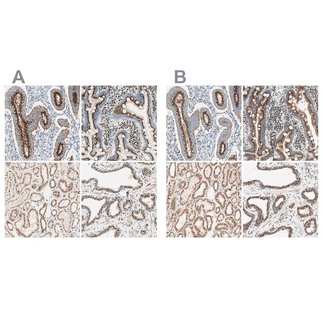 Anti-GOLGB1 antibody produced in rabbit