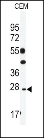 Anti-GOSR2 (N-term) antibody produced in rabbit