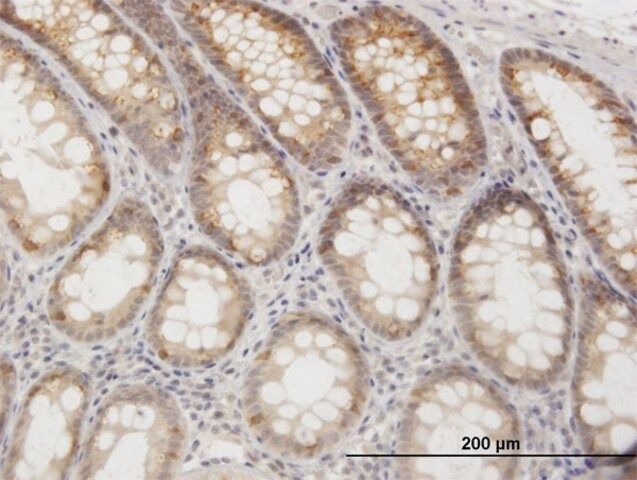 Anti-GOT1 antibody produced in rabbit