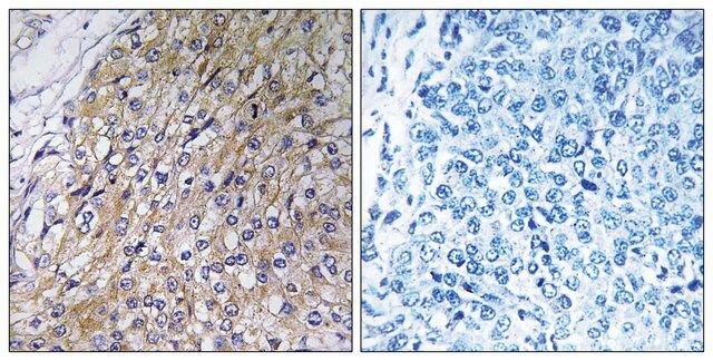 Anti-GOLT1A antibody produced in rabbit