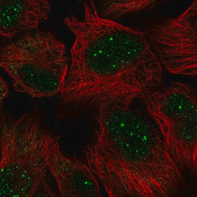 Anti-GON4L antibody produced in rabbit