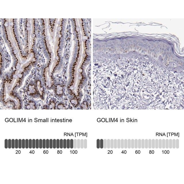 Anti-GOLIM4 antibody produced in rabbit