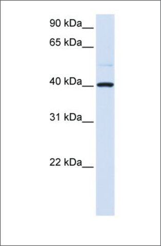 Anti-GOT2 antibody produced in rabbit