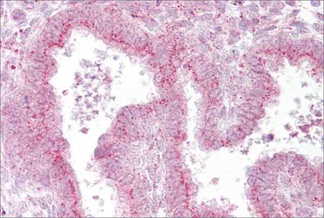 Anti-GOLGB1 antibody produced in rabbit