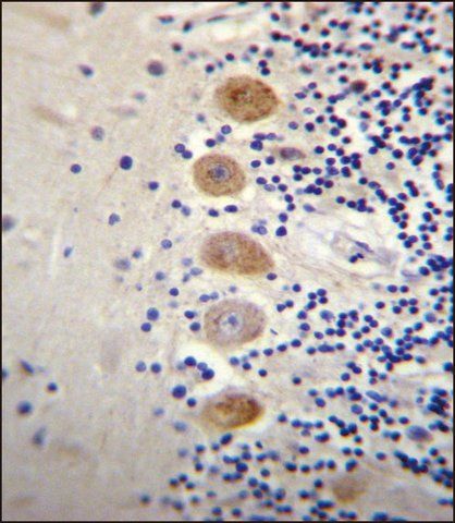 ANTI-GP111 (CENTER) antibody produced in rabbit