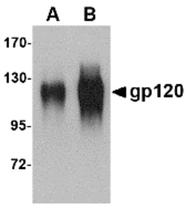 Anti-gp120 antibody produced in goat