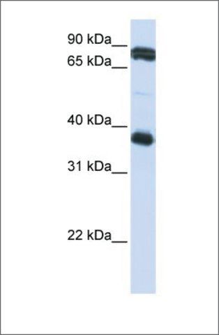 Anti-GP6 antibody produced in rabbit