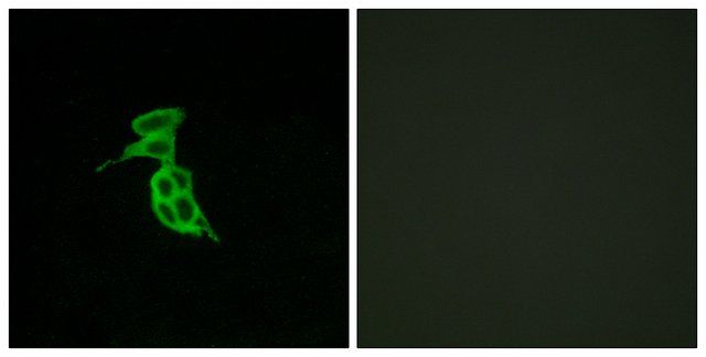 Anti-GPR143 antibody produced in rabbit