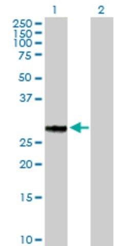 Anti-GFOD2 antibody produced in mouse