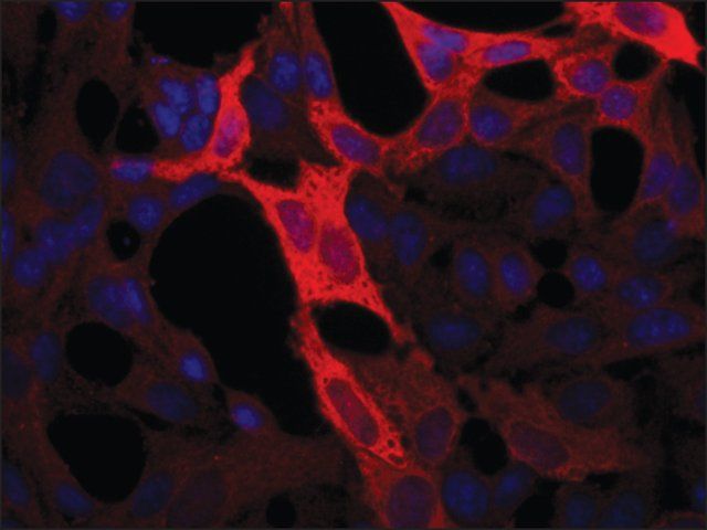 Anti-Gigaxonin (N-terminal) antibody produced in rabbit