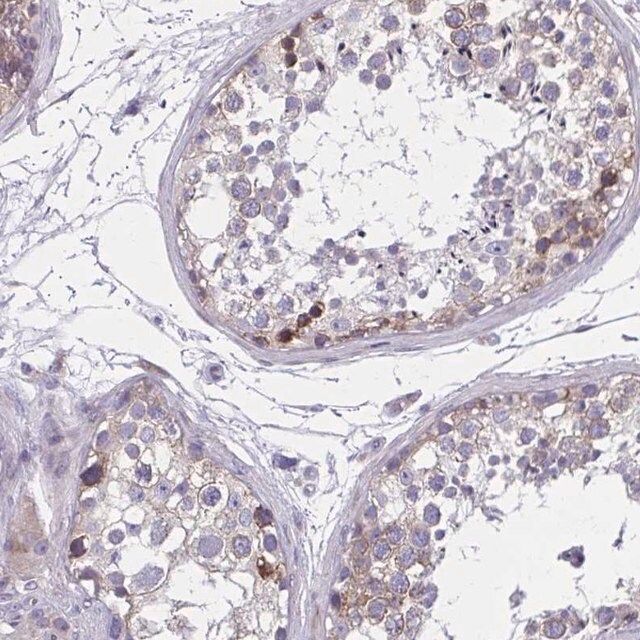 Anti-GIGYF2 antibody produced in rabbit