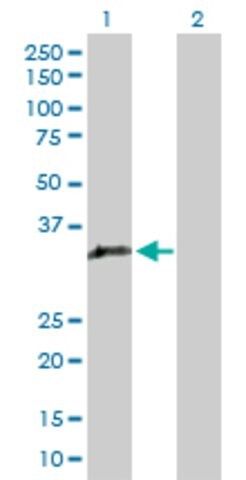 Anti-GIMAP5 antibody produced in rabbit